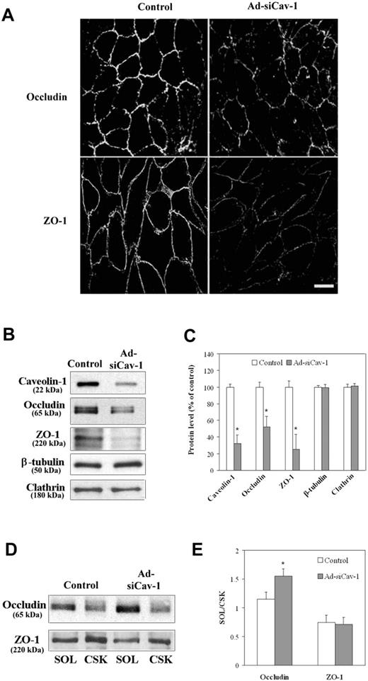 Figure 2. Ad-siCav-1 causes loss and redistribution of TJ-associated proteins. BMECs were exposed to Ad-siCav-1 or Ad-siLuc (control) at 500 ifu per cell for 96 hours and then subjected to analysis. (A) Immunofluorescent staining for occludin and ZO-1 showing reduced and fragmented staining patterns following Ad-siCav-1 exposure. Scale bar represents 50 μm. Western blotting (B) and corresponding quantification (C) showing loss of occludin and ZO-1 in response to Ad-siCav-1. Western blotting (D) and corresponding quantification (E) revealing a significant shift in the association of occludin from the cytoskeletal framework (CSK) to the soluble (SOL) fraction of BMECs (increased SOL/CSK ratio) as a result of Ad-siCav-1 treatment. Because equal amounts of total protein were analyzed in panel B, while equal aliquots (cellular equivalents) were analyzed in panel D, protein intensities between these 2 figures are not comparable. Blots are representative of 3 experiments. Data are presented as mean ± SE of all 3 experiments. *P < .01.