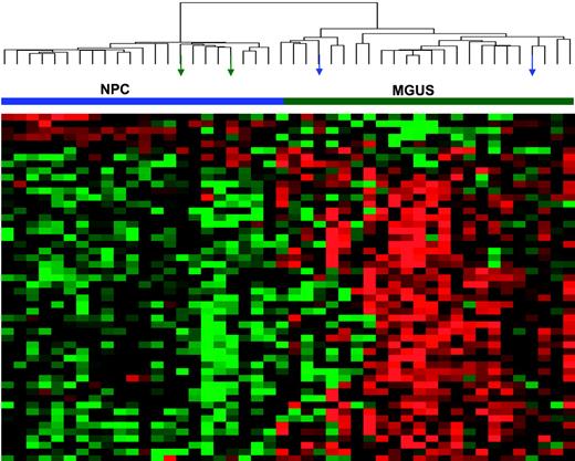 Figure 1. Expression patterns of 52 genes differentially expressed in PCs of healthy donors (NPC) and patients with MGUS. Two-dimensional unsupervised hierarchical cluster analysis of 52 genes (rows) in CD138-enriched plasma cells from 22 healthy donors and 24 MGUS patients (columns). Mean-centered gene expression is depicted by a normalized-signal pseudocolor scale, as described.21 Red and green indicate overexpressed and underexpressed genes, respectively. Sample dendrogram (top), reflecting relatedness among samples, consists of 2 major branches defined by overexpressed and underexpressed genes. The left branch consists of 22 NPC samples (horizontal blue bar) and 2 MGUS samples (green arrows), whereas the right branch contains all MGUS (horizontal green bar) and a subset of 2 NPC samples (blue arrows).