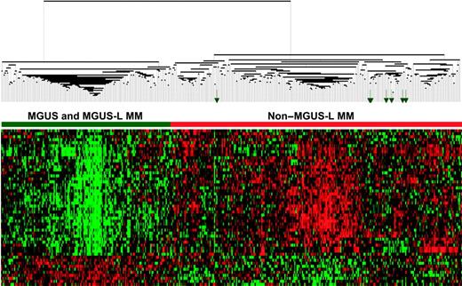 Figure 2. Expression patterns of 52 genes segregate MGUS and MGUS-L MM from non–MGUS-L MM. Two-dimensional unsupervised hierarchical cluster analysis of 52 MGUS genes (rows) in CD138-enriched plasma cells of patients with MGUS (n = 56), MM from MGUS (n = 16), and newly diagnosed MM (n = 351) (columns). The left branch consists of MGUS and MGUS-like MM samples (horizontal green bar), and the right branch contains the non–MGUS-L MM (horizontal red bar). Green arrows represent MGUS patients (MM-L MGUS).