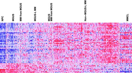 Figure 3. Expression levels of the 52 MGUS genes in PC of healthy donors and patients with MGUS and MM. A colorgram of the expression of the 52 genes in NPC (n = 22), MGUS, MM from MGUS (n = 72), and MM (n = 351) (based on their location in either of the 2 major branches of the dendrogram in Figure 2) and multiple myeloma cell lines (MMCLs) (n = 22). MGUS and MM from MGUS on the left side of the figure represent clusters in the MGUS-L MM branch of Figure 2, and those on the right side represent clusters in the non–MGUS-L MM branch. Genes are indicated along the vertical axis and samples on the horizontal axis. The normalized expression value for each gene is indicated by a color, with red representing high expression and blue representing low expression. Note that NPCs have a distinct pattern of overexpressed and underexpressed genes that progressively inverts with transition to MGUS, MGUS-L MM, non–MGUS-L MM, and finally to MMCL.