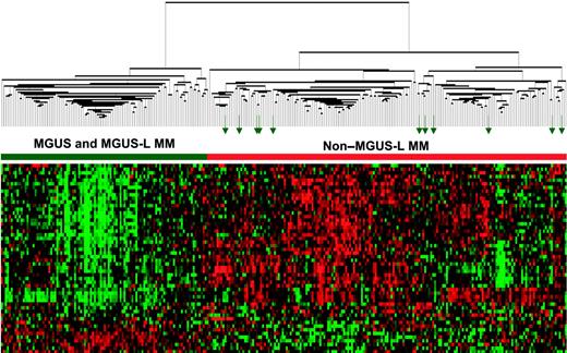Figure 6. MGUS-L signature is discernible in a test cohort of patients with newly diagnosed MM enrolled in TT3. As in Figure 2, a 2-dimensional unsupervised hierarchical cluster analysis of 52 genes (rows) in CD138-enriched plasma cells from MGUS (n = 56), MM from MGUS (n = 16), and newly diagnosed MM (n = 214). Green arrows represent MGUS clusters with so-called non–MGUS-L MM.