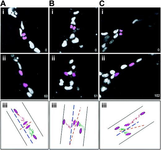 Figure 3. Daughter cells maintain their division orientation as they migrate after most divisions. ES cell–derived vessels (WT; Tg PECAM H2B-GFP) were imaged, and after divisions were scored (i panels) the 2 daughter nuclei (pink) were followed for 1 to 2 hours further. The numbers in the lower right represent elapsed time in minutes. In all cases ii panels show the final image scored. The iii panels diagram the movement of each daughter nucleus (shown in pink) after division: one daughter nucleus is tracked with a green line and the other with a pink line. The vessel is shown by black lines, the vessel long axis is shown by the broken blue line, and the division angle is shown by the broken orange line. (A) A division perpendicular to the vessel long axis, where the daughter cells maintained the division orientation after 1 hour (n = 61 of 61). (B) A division parallel to the vessel long axis, where the daughter cells maintained the division orientation after 1 hour (n = 7 of 10). (C) A division parallel to the vessel long axis, where the daughter cells changed position relative to the division orientation after 102 minutes (n = 3 of 10).