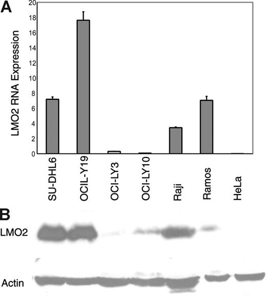 Figure 1. Specificity of anti-LMO2 monoclonal antibody and correlation with LMO2 mRNA expression. (A) Immunoblot analysis using the anti-LMO2 monoclonal antibody shows a specific band corresponding to LMO2 protein expression in HeLa cells stably transfected with LMO2 but not in native or mock-transfected HeLa cells. (B) LMO2 mRNA and protein expression were analyzed by real-time RT-PCR in GC-like (SU-DHL-4, OCI-LY7) and in non–GC-like (OCI-LY3, OCI-LY10) DLBCL cell lines and in Raji, Ramos, and HeLa cell lines. Immunoblot analysis shows that LMO2 protein expression corresponds to LMO2 mRNA expression in the cell lines analyzed. Error bars indicate average of 2 triplicate RT-PCR experiments.
