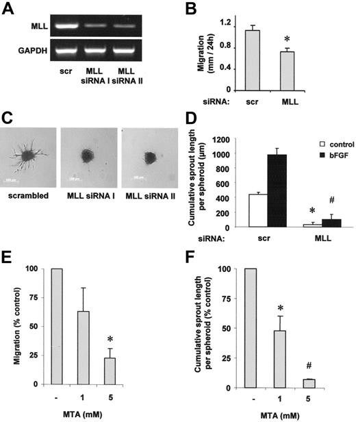 Figure 1. MLL regulates endothelial-cell migration and sprouting. (A,C) HUVECs were transfected with 2 different siRNAs against MLL (I and II) or scrambled oligonucleotides. (A) RT-PCR analysis of MLL mRNA expression. A representative gel is shown. GAPDH serves as loading control. (B,D) HUVECs were transfected with MLL siRNA or scrambled oligonucleotides. (B) Cell migration was measured using a scratched wound assay. Data are shown as mean ± SEM. *P < .05, n = 3. (C) A spheroid assay was performed to analyze basal endothelial sprouting capacity. Representative spheroids are shown. (D) Analysis of endothelial sprouting capacity with or without bFGF (30 ng/mL) stimulation. Endothelial sprouting capacity is given as cumulative sprout length per spheroid. Data are shown as mean ± SEM. *P < .01 versus scrambled and #P < .01 versus scrambled + bFGF, n = 3. (E) HUVECs were prestimulated with different doses of the methyltransferase inhibitor MTA as indicated and stimulation was repeated following scratch procedure. Migration was measured using the scratched wound assay. Data are shown as percent control and mean ± SEM. *P < .05 versus control, n = 3. (F) HUVEC capillary sprouting was analyzed in the presence of different doses of MTA as indicated. Data are shown as percent control and mean ± SEM. *P < .05 versus control; #P < .01 versus control, n = 3.