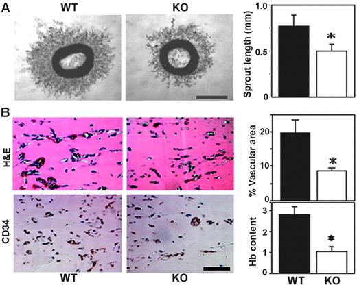 Figure 1. CD151-null mice show diminished angiogenesis, ex vivo and in vivo. (A) Thoracic aortic rings were embedded in Matrigel and incubated for 4 days. Shown are phase-contrast images of branching vessel-like structures in WT and CD151-null explants. Lengths of vessel-like structures were quantitated (n = 6; *P < .005). (B) After implantation for 7 days, sections of Matrigel plugs were stained with hematoxylin and eosin (H&E) and for endothelial marker CD34. Percentage of vascular area stained with CD34 was calculated, in 5 fields, using Scion Image software. Results are shown as the mean ± SEM. (*P < .01). Hemoglobin content was also determined (n = 5; *P < .05). Data are representative of 3 independent experiments with similar results. Scale bars represent 1 mm (A) and 100 μm (B). Bar graphs in panels A-B, and in every other figure, show mean ± SEM.