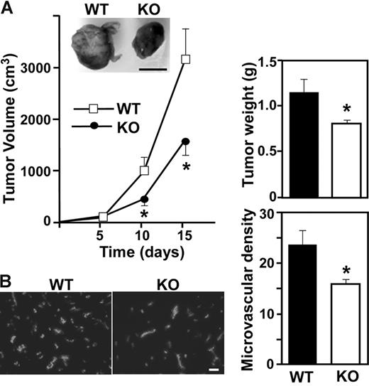 Figure 2. Impaired tumor angiogenesis in Cd151-null mice. (A) LLC tumor growth was assessed in 10 age- and sex-matched WT and knockout (KO) mice. Data are representative of 5 independent experiments. From tumors such as shown in the photo, tumor volume and tumor weight were calculated (n = 10; *P < .05). (B) Cryosections of LLC tumors were stained for endothelial marker CD31 and the number of CD31+ blood vessels was counted (*P < .01). Scale bars represent 1 cm (A) and 100 μm (B).