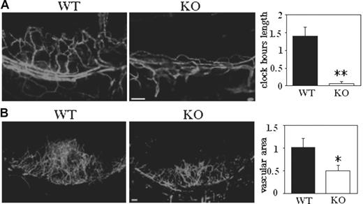 Figure 3. Corneal angiogenesis is deficient in Cd151-null mice. (A) Five days after implantation of pellets containing 20 ng bFGF, vessels were stained with PE-conjugated anti-CD31. Clock-hour length of sprouting vessels was quantitated (**P < .005). (B) Corneal pellets contained 40 ng bFGF. After 5 days, vessels were stained with anti-CD31, and vascular area was quantitated (*P < .05). Scale bars represent 100 μm in panels A-B.