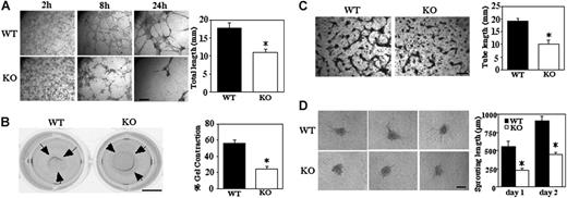 Figure 5. Impaired 3-dimensional functions on Matrigel and collagen. (A) MLECs were seeded on Matrigel and photographed at indicated times (bar = 1 mm). Total length of cellular cables was quantitated after 24 hours (*P < .001). (B) Representative photographs of Matrigel contraction data are shown for WT and Cd151-null MLECs (bar = 5 mm). Percent contraction (after 18 hours) is the average gel diameter/well diameter × 100 (*P < .05). Data are representative of 3 independent experiments with similar results. (C) MLECs were incubated within collagen gel for 48 hours, then fixed, stained with toluidine blue, and photographed (bar = 1 mm). Total tube length is quantitated (n = 2; *P < .05). (D) Representative images are shown of capillary-like structures sprouting from MLEC spheroids after 48 hours (bar = 100 μm). Total sprouting length is quantitated (*P < .005). Data are representative of 3 independent experiments with similar results. Note that the initial size of spheroids, when first transferred to collagen gel, was similar for WT and Cd151-null cells (136 ± 12 μm and 145 ± 13 μm, respectively).