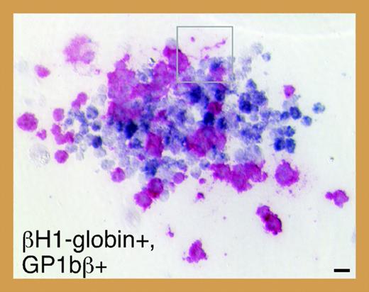 Meg-CFCs and 2 novel bipotential MEPs emerge during embryonic hematopoiesis. See the complete figure in the article beginning on page 1433.