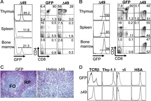Figure 5. Expression of the Helios Δ49-285 isoform results in T-cell lymphoma. (A) FACS analysis of hematolymphoid tissues in a nonsick Helios Δ49-285 animal at 5 months after transplantation showing an abnormal frequency of CD4 SP thymocytes among cells that are GFP+. The abnormal accumulation of CD4+ (or CD8+ in some cases) cells was restricted to the thymus at early stages of lymphoma. The extent of GFP chimerism in each tissue for the nonsick Δ49-285 Helios animal is shown in the left column. (B) FACS analysis of a moribund Helios Δ49-285 animal at 7 months after transplantation indicating high frequencies of GFP+ cells in the thymus and abnormal accumulation of DP and CD8 SP thymocytes in the spleen and bone marrow. Numbers in the quadrants of each plot represent percentages of the indicated populations among gated GFP+ cells. (C) Splenic architecture was severely disrupted in animals exhibiting lymphoma. FO indicates lymphoid follicle; RP, red pulp; original magnification, × 160. (D) Characterization of cell-surface marker profiles of lymphoma cells in the thymus of a representative moribund Δ49-285 Helios animal (n = 5) versus the GFP control. Analysis was done on gated GFP+ cells.