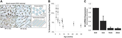 Figure 1. Postnatal angiogenesis and vascular remodeling in the heart. The cardiac coronary capillary bed undergoes significant vascular remodeling during a postnatal period of myocyte hypertrophy. (A) Immunostaining for PECAM-1/CD31 shows capillaries in cross section (top) or transverse section (bottom) for 1- and 6-week-old wild-type mice. The schematic illustrates how myocytes (blue) and capillaries (brown) are organized in the adult heart for homogeneous tissue oxygenation. Using TEM, a blinded observer examined several hundred coronary capillaries per mouse and recorded the frequency of luminal filopodia, expanded vacuoles, and/or intussusception. These characteristics of immature, angiogenic blood vessels were observed more frequently in neonatal mice (1 to 3 weeks old) of either sex (B). β3 integrin mRNA expression, considered a marker of angiogenic endothelium, decreases rapidly with age following birth on a similar time scale as capillary maturation (C). (A) Scale bar = 5 μm. (B-C) Data represent mean ± SE.