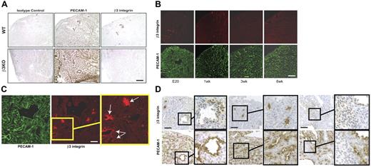 Figure 2. β3 integrin protein expression in the mouse heart. Immunostaining serial sections for PECAM-1 and β3 integrin confirms the hamster antimouse antibody can detect β3 protein expression in wild-type (but not β3-null) mouse hearts (A). During the first few postnatal weeks, β3 protein expression decreases and is only faintly detected on smooth muscle cells on small arteries in the adult heart (B). In late-stage embryo hearts, β3 integrin is found near areas of vascular remodeling (C, arrows indicate clusters of vessels) or associated with vascular structures (D, left), interstitial cells (D, middle), and myocytes (D, right). Bar = 100 μm (A-B) or 200 μm (C-D).