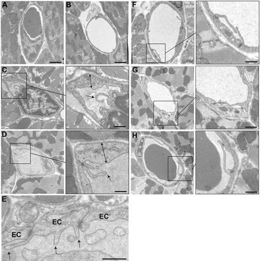 Figure 4. Male β3-null coronary capillaries appear immature and angiogenic.Transmission electron micrographs show that coronary capillaries from adult wild-type mice (A-B) are composed of endothelial cells with a smooth luminal surface and uniform thickness around the vessel perimeter. In contrast, coronary capillaries from adult male β3-null mice (C-E) often have irregular endothelial-cell thickness (arrows) along with filopodia extending into the vessel lumen (arrows). The luminal filopodia can originate from cell-cell junctions as well as from the central region of a single endothelial cell (E). All filopodia appear to extend toward the vessel lumen rather than into the extravascular space. The frequent presence of organelles such as mitochondria and ribosomes in regions of thickened endothelium is consistent with activated endothelial cells. Luminal filopodia in male β3-null coronary capillaries appear to extend toward (F) or interact with (G-H) adjacent filopodia. The presence of electron-dense staining at points of contact suggests that interactions between filopodia may represent adhesive events. Connections between filopodia appear to form pockets within a single vessel lumen, consistent with angiogenesis by division of existing vessels. Bar = 500 nm.