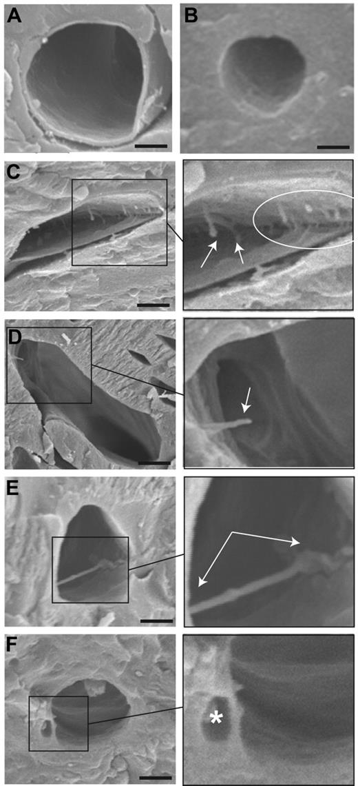 Figure 6. Blood vessel phenotype in male β3-null mice is confirmed by scanning electron microscopy. Coronary capillaries from adult wild-type mice (A-B) have a smooth luminal surface consistent with images acquired using TEM. Freeze-fractured samples prepared for SEM reveal filopodia extending into the vessel lumen (C-D) or across the lumen to make adhesive contact with the opposite wall (E). Luminal divisions are visible, which may represent the expanded vacuoles observed via TEM (F). Arrows indicate filopodia; asterisk, expanded vacuole. Bar = 500 nm.
