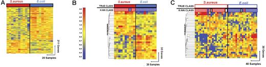 Figure 3. Discriminating patients with S aureus infections from patients with E coli infections. (A) Hierarchical clustering of 211 genes obtained from Mann-Whitney rank test comparison (P < .01) between 2 groups: Staphylococcus aureus (S aureus, 10 samples, red rectangle) and Escherichia coli (E coli, 10 samples, blue rectangle) infections. Transformed expression levels are indicated by color scale, with red representing relative high expression and blue indicating relative low expression compared to the median expression for each gene across all donors. Genes are listed in Table S4. (B) A supervised learning algorithm was used to identify 30 genes presenting the highest capacity to discriminate the 2 classes (Table S6). Leave-one-out cross-validation of the training set with 30 classifier genes grouped the samples with 95% accuracy. (C) The 30 classifier genes thus identified were tested on an independent set of patients (open rectangles), including 21 new patients with S aureus and 19 with E coli infections. The 40 samples in this test set were predicted with 85% accuracy (predicted class is indicated by light-colored rectangles). Of these 40 samples, only 2 were misclassified, whereas the class of 4 other samples could not be determined (open rectangles).