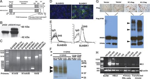 Figure 1. K1 encodes a transmembrane protein with an immunoreceptor tyrosine-based activation motif (ITAM). (A) Schematic of K1 protein with the ITAM consensus amino acid sequence. The K1 gene encodes for a single transmembrane (TM) protein with a short cytoplasmic (CY) sequence that contains an ITAM. The mutant K1 gene (K1m) has a truncated ITAM. Above the bars are the amino acid numbers. The arrows below the bars indicate the locations and names of the oligonucleotide primers used for PCR. (B) K1myc expression in transfected HEK 293 cell extracts subjected to immunoprecipitation and immunoblotting with an anti-myc antibody. A unique band with an estimated size of approximately 50 kDa was present in lysates of HEK 293 cells transfected with pSG5K1myc. (C) PCR analysis of K1 expression in the BJAB cells stably transfected with pLXSN vectors expressing K1 (BJABK1) or K1m (BJABK1m) or with pLXSN alone (BJABXS) after selection of cells with G-418 antibiotic. The sizes of the bands are consistent with the predicted DNA sizes. (D) Expression of K1-encoded protein in BJAB cells. Cells were stained with the primary anti-K1 antibody 2H5 and a secondary anti–mouse IgG–FITC antibody. Images were visualized using an Olympus BX51 TF fluorescence microscope (Olympus Optical, Tokyo, Japan) equipped with a 40×/0.75 numerical aperture (NA) objective. Images were captured using an Olympus DP21 camera system. (E) Flow-cytometry analysis of the expression of K1 on the surface of BJAB transfectants. BJAB transfectants were stained with 2H5 and the anti–mouse IgG–FITC antibody. As a control, each experimental histogram is overlaid with mouse isotype IgG-stained BJAB transfectants. (F) HHV-8–infected cells show the presence of K1 in monomer and aggregate forms by immunoprecipitation-immunoblotting analysis. (G) Mice transfected with K1-Flag show the presence of K1 (arrowheads). Images were visualized using a Zeiss Axioskop 2 plus (Zeiss Microimaging, Thornwood, NY) equipped with a 20×/0.50 NA objective. Images were captured using a Zeiss MC 80 DX camera, and were scanned using an HP Scanjet 8200 (Hewlett-Packard, Palo Alto, CA). (H) Total RNA was isolated from transfected mouse liver and cells. RNA from equal numbers of BJAB cells, cells from the HBL6 cell line, primary human PEL cells, and mouse liver cells was subjected to RT-PCR. β-actin mRNA was amplified as an internal control for input mRNA.