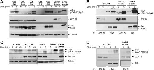 Figure 1. ZAP-70 is not phosphorylated on positive regulatory tyrosine residues following BCR stimulation in CLL B cells. (A) Immunoblotting analysis of total cellular extracts from 3 ZAP-70+ (G25, G56, and G10) and 2 ZAP-70− CLL samples (G17 and G98) using the phospho-ZAP-70Tyr319/SykTyr352 antibody. Cells were stimulated with anti-IgM, as indicated. Jurkat T cells stimulated for 5 minutes with anti-CD3 antibody were used as a positive control for ZAP-70 activation. BJAB B cells stimulated for 5 minutes with anti-IgM were used as a positive control for Syk activation. The same membrane was reprobed with anti–ZAP-70, anti-Syk, and antitubulin antibodies, as indicated in the bottom panels. Arrows indicate the expected position of the ZAP-70, Syk, and SykB proteins. (B) Immunoblotting analysis with phospho-ZAP-70Tyr319/SykTyr352 antibody of ZAP-70 and Syk proteins immunoprecipitated from unstimulated or anti-IgM–stimulated ZAP-70+ CLL B cells (sample G4) is shown in the top panel. Jurkat T cells unstimulated or stimulated with anti-CD3 were used as a positive control for ZAP-70 phosphorylation, whereas unstimulated or anti-IgM–stimulated BJAB B cells were used as a positive control for Syk phosphorylation. The total amount of immunoprecipitated ZAP-70 and Syk protein is shown in the bottom panels. (C) Immunoblotting analysis of total cellular extracts from ZAP-70+ and ZAP-70− CLL B cells, BJAB B cells, and Jurkat T cells using the phospho-ZAP-70Tyr493 antibody, which also cross-reacts with phospho-SykTyr526. Stimulation with anti-IgM or anti-CD3 was performed for the indicated times. (D) Immunoblotting analysis of immunoprecipitated ZAP-70 and Syk from unstimulated or anti-IgM–stimulated ZAP-70+ CLL B cells. Jurkat T cells stimulated with anti-CD3 are shown as a positive control for ZAP-70 activation. Membranes were probed with the same phospho-ZAP-70/Syk antibody as in panel C (top panels) and reprobed with anti–ZAP-70 (middle panels) and anti-Syk (bottom panel).