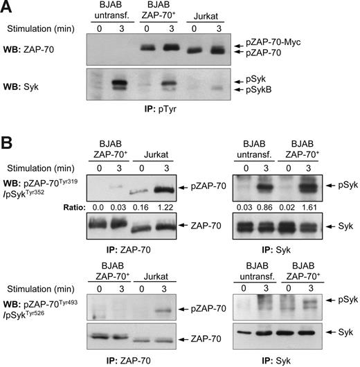 Figure 2. Tyr319 and Tyr493 in ZAP-70 are inefficiently phosphorylated following IgM ligation in stable BJAB transfectants. (A) Immunoblotting analysis of immunoprecipitated tyrosine-phosphorylated proteins from parental and ZAP-70 transfectant BJAB B cells (unstimulated or anti-IgM stimulated) and Jurkat T cells (unstimulated or anti-CD3 stimulated). Membranes were probed with anti–ZAP-70 (top panel) and anti-Syk (bottom panel). The band corresponding to ZAP-70 in BJAB is 1 kDa bigger than the band corresponding to endogenous ZAP-70 in Jurkat T cells due to the presence of the Myc tag. The expected positions of ZAP-70, ZAP-70-Myc, Syk, and SykB are indicated by arrows. (B) ZAP-70 and Syk were immunoprecipitated from parental and ZAP-70–transfected BJAB B cells and from Jurkat T cells and analyzed by immunoblotting with phospho-ZAP-70Tyr319/SykTyr352 (top panels) or phospho-ZAP-70Tyr493/SykTyr526 antibody (bottom panels). The ratio of ZAP-70 phosphorylated at Tyr319 and total ZAP-70 was quantified by densitometry.