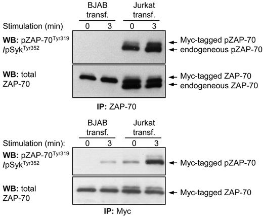 Figure 3. Phosphorylation of Tyr319 in ectopically expressed ZAP-70 is significantly less efficient in BJAB B cells than in Jurkat T cells. Immunoblotting analysis of immunoprecipitated ZAP-70 protein from transiently transfected BJAB B cells and Jurkat T-cells was done with the phospho-ZAP-70Tyr319/SykTyr352 antibody. The pcDNA3-ZAP-70-Myc construct was introduced into both cell lines by nucleofection. In the top panels both Myc-tagged and endogenous ZAP-70 proteins were immunoprecipitated with an anti–ZAP-70 antibody. The 2 proteins differ in size by 1 kDa because of the Myc tag. The bottom panels show analysis only of Myc-tagged ZAP-70 that was immunoprecipitated with an anti-Myc antibody.