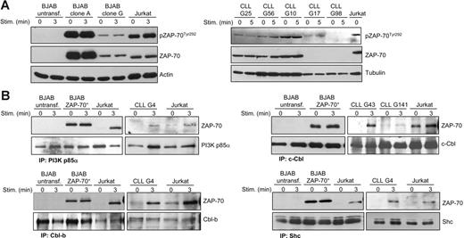 Figure 4. Tyr292 phosphorylation and interaction of ZAP-70 with PI3K p85α, c-Cbl, Cbl-b, and Shc. (A) Immunoblotting analysis with phospho-ZAP-70Tyr292 antibody of total cellular extracts from parental BJAB B cells, 2 BJAB clones expressing different levels of ZAP-70 (clone A and clone G), Jurkat T cells, and ZAP-70+ (G25, G56, and G10) or ZAP-70− (G17 and G98) CLL B cells. Cells were stimulated with anti-IgM or anti-CD3, as applicable. (B) Immunoblotting analysis with anti–ZAP-70 antibody of protein complexes immunoprecipitated with PI3K p85α, c-Cbl, Cbl-b, and Shc antibodies. Immunoprecipitations were performed before and after antigen receptor stimulation on parental and ZAP-70–transfected BJAB B cells, Jurkat T cells, and CLL B cells, as indicated. Membranes were reprobed with antibodies against p85α, c-Cbl, Cbl-b, and Shc to evaluate the quantity of immunoprecipitated proteins.