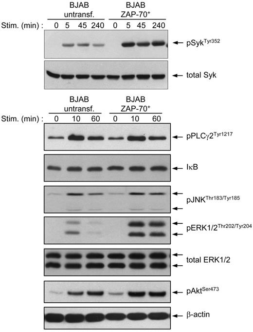 Figure 5. BJAB B cells transfected with ZAP-70 show stronger and prolonged activation of Syk, ERK, and Akt after BCR stimulation. Parental and ZAP-70–transfected BJAB B cells were stimulated with anti-IgM for the indicated times and analyzed by immunoblotting with phospho-ZAP-70Tyr319/SykTyr352, phospho-PLCγ2Tyr1217, IκB-α, phospho-JNKThr183/Tyr185, phospho-ERK1/2Thr202/Tyr204, and phospho-AKTSer493 antibodies. To ensure equal loading, membranes were stripped and reprobed with anti-Syk (top) or anti-ERK1/2 and anti–β-actin (bottom).