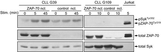 Figure 6. Analysis of ZAP-70 and Syk activation in transiently transfected primary CLL B cells. Primary CLL B cells lacking endogenous ZAP-70 were transiently transfected by nucleofection (ncl) with ZAP-70 or with empty vector as control. Sixteen hours after nucleofection the cells where stimulated for the indicated times with anti-IgM. Immunoblotting was performed with phospho-ZAP-70Tyr319/SykTyr352 antibody, followed by anti–ZAP-70 and anti-Syk.