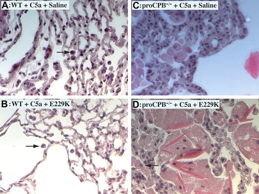 Figure 3. C5a-induced alveolitis in WT and proCPB−/− mice. Representative lung tissue samples of C5a-induced alveolitis from WT mice in the absence (A) or presence (B) of pretreatment with E229K thrombin and from proCPB−/− mice in the absence (C) or presence (D) of pretreatment with E229K thrombin. Black arrows show macrophages. Images at 200× total magnification were visualized using a Zeiss Axiovert 40 CFL microscope equipped with an A-plan 20×/0.30 numerical aperture ph1 objective lens (Zeiss, Dublin, CA). Images were captured and rendered using a Zeiss AxioCam camera and AxioVision AC software.