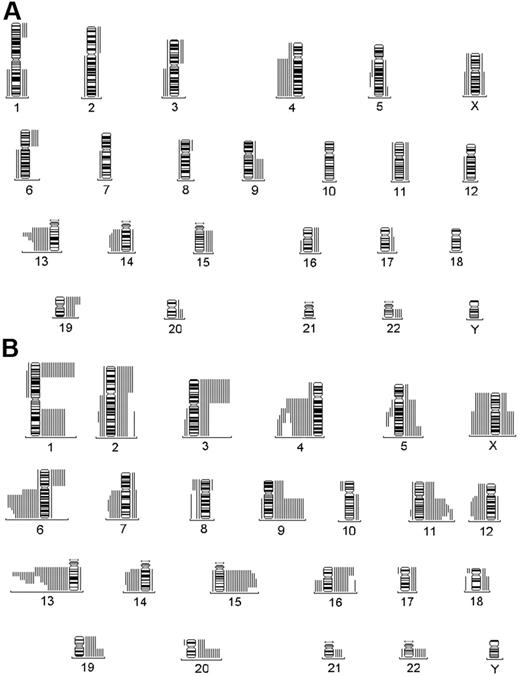 Figure 1. Genetic alterations by CGH. Summary of total genetic alterations detected by CGH in (A) MGUS and (B) MM. Each line represents the affected region of the chromosome in a single case. Gains are shown on the right side of the ideograms and losses on the left.