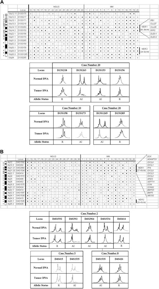Figure 3. Delineation of MDRs. Delineation of MDRs is shown for chromosomes (A) 13q and (B) 4q. The top panels show the microsatellite markers analyzed and their respective chromosomal locations. Vertical lines on the right denote the MDRs defined in each chromosomal region, and candidate genes selected for further mRNA expression analysis are listed beside the MDRs. Filled circles denote allelic imbalance (AI); unfilled circles, retention (R); and dash, noninformative at each specific loci examined. The electropherograms of representative cases for defining the MDRs are shown in the bottom panels.