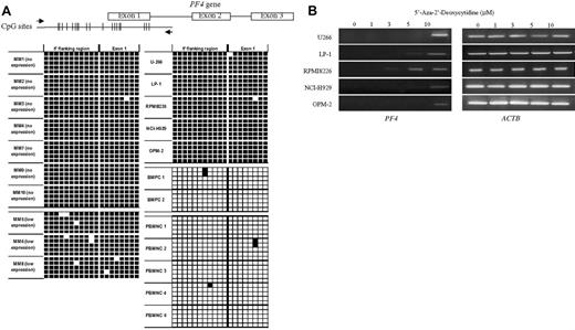 Figure 6. Methylation analysis of PF4 gene in primary MM, MM cell lines, and normal cells. (A) Schematic diagram showing the location of CpG sites at the 5′ promoter region and exon 1 of PF4 gene. Black arrows show the primers used for the amplification of the PCR product for bisulfite sequencing. Relative positions of CpG dinucleotides are indicated by vertical lines. The graphic below illustrates the results of bisulfite sequencing, with filled boxes indicating methylation and white boxes unmethylation at each CpG site. Five clones are analyzed for each sample. (B) 5′-Aza-2′-deoxycytidine (5′-Aza) demethylation treatment in MM cell lines. Restoration of PF4 expression in all MM cell lines was observed after treatment with 1, 3, 5 or 10 μM of 5′-Aza for 4 days. ACTB expression was examined for internal control.