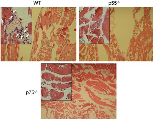 Figure 5. Both TNF-α receptors are critical for TNF-α–induced leukocyte transmigration. Cumulative effect of TNF-α on leukocyte infiltration to the interstitial space of the cremaster muscle. Following 3 hours of TNF-α treatment, acetone-fixed cremaster specimens were subjected to hematoxylin-and-eosin staining to observe infiltrated leukocytes. Arrows show the infiltrated leukocytes.