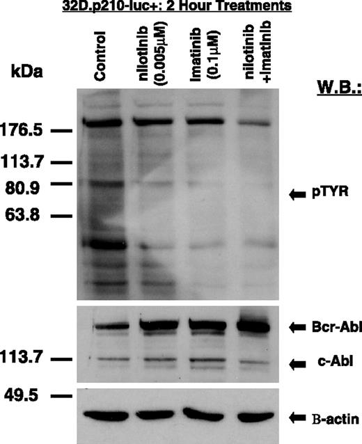 Figure 5. Inhibition of cellular tyrosine phosphorylation in BCR-ABL–expressing cells by imatinib and nilotinib, combined. Immunoblot showing inhibitory effects of nilotinib and imatinib (alone and combined) on total cellular tyrosine phosphorylation and BCR-ABL expression in nonmutated BCR-ABL–expressing cells. Immunoblot was hybridized with a beta-actin antibody as a loading control.