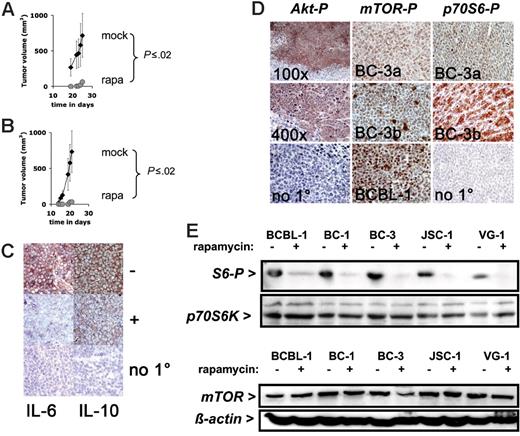 Figure 3. Response to rapamycin of experimental tumors. (A) Shown on the vertical axis is the tumor volume in mm3 and on the horizontal axis the time since inoculation with 106 BC-1 cells and simultaneous treatment with rapamycin (n = 5) or vehicle (n = 4). (B) Shown on the vertical axis is the tumor volume in mm3 and on the horizontal axis the time since inoculation with 106 BC-1 cells and treatment with rapamycin (n = 5) or vehicle (n = 4) animals after the establishment of tumors (day 14). Error bars indicate the SD for each group of animal. For rapamycin-treated animals the error bar is smaller than the symbol. (C) Expression of IL-6 in a mock-treated (−) BC-1 tumor (red color), which is reduced by rapamycin treatment (+). Expression of IL-10 in a mock-treated BC-1 tumor (−) (red color), which is reduced by rapamycin treatment (+). No staining in the absence of the specific primary antibody (no 1°). All sections are counterstained with hematoxilin (blue) and are at 400 × magnification. (D) Representative immunohistochemistry of mouse xenograft tumors using antibodies specific for phospho-Akt (Akt-P), phospho-mTOR (mTOR-P), and phospho-p70S6 kinase (p70S6-P). The phospho Akt staining was performed on BCBL-1 tumors at either 100 × or 400 × magnification. No 1° indicates the no primary antibody control reaction. The phospho-mTOR and phospho-p70S6K staining was performed on 2 different tumors (BC-3a and BC-3b) derived from the BC-3 cell line; No 1° indicates the no primary antibody control reaction. Pictures here were taken at 400 × magnification. (E) Western lot analysis of protein extracts for the indicated cell lines exposed to rapamycin or vehicle using anti–phospho-S6 and anti-p70S6 kinase antibody. (F) Western blot analysis of protein extracts for the indicated cell lines exposed to rapamycin or vehicle using anti-mTOR and antiactin antibody.