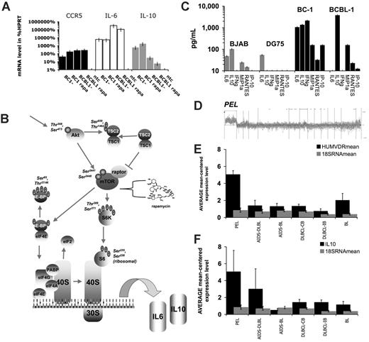 Figure 6. Cytokine mRNA levels predict PEL class membership. (A) Relative mRNA levels for CCR5, IL-6, and IL-10 as determined by real-time QPCR and expressed as the percentage of HPRT mRNA levels for BC-1 and BCBL-1 cells treated with rapamycin (rapa) or mock-treated; ntc indicates nontemplate control. (B) Summary of rapamycin signaling pathways in PEL (adapted from Science Slides 2005, VisiScience, Chapel Hill, NC). (C) Secreted cytokine levels in picogram per milliliter (log-scale) for virus-negative BJAB and DG75 and KSHV-positive BC-1 and BCBL-1 cell lines. Cytokines are listed on the horizontal axis. (D) Relative levels (vertical axis) of all mRNAs that can be used to predict class membership to PEL of a set of 101 lymphomas (horizontal axis). From this set the relative mRNA for vitamin D receptor (E) and IL-10 (F) levels were mean-centered across n = 101 Affymetrix datasets and averaged for PEL (n = 9), AIDS-associated Burkitt lymphoma (AIDS-BL) (n = 7), AIDS-associated diffuse large B-cell lymphoma (DLBCL) (n = 9), classic, non–AIDS-associated BL (n = 6), non–AIDS-associated DLBCL of immunoblast type (n = 8), non–AIDS-associated DLBCL of centroblast type (n = 23). Histograms show mean and standard deviation. Gray bars indicated 18S RNA levels as control.