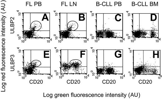 Figure 2. Expression of ULBP2 and ULBP3 in NHL B cells. ULPB2 (A-D) or ULBP3 (E-H) expression at the cell surface of PB or LN B lymphocytes in FL NHL (A-B, E-F, 1 representative case of 15 studied) or of PB or BM B lymphocytes in B-CLL (C-D, G-H, 1 representative case of 10 studied), as indicated. B lymphocytes are identified by FITC-conjugated anti-CD20 mAb. Expression of ULBP2 and ULBP3 was assessed by indirect immunofluorescence, with the specific mAbs followed by isotype-specific PE-GAM immunoglobulin and FACS analysis. Results are expressed as log green fluorescence intensity (au) versus log red fluorescence intensity (au).
