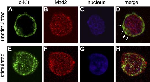 Figure 7. Mad2 colocalizes with c-Kit in cytoplasm in MO7e cells. Top (A-D) and bottom (E-H) panels show unstimulated and cytokine-stimulated MO7e cells, respectively. Images were acquired by confocal microscopy with an oil immersion lens (magnification, × 100). c-Kit is shown in green (A,E), Mad2 in red (B,F), and nucleus in blue (C,G). Merged images are shown in panels D and H. Arrows indicate representative colocalization of Mad2 with c-Kit.