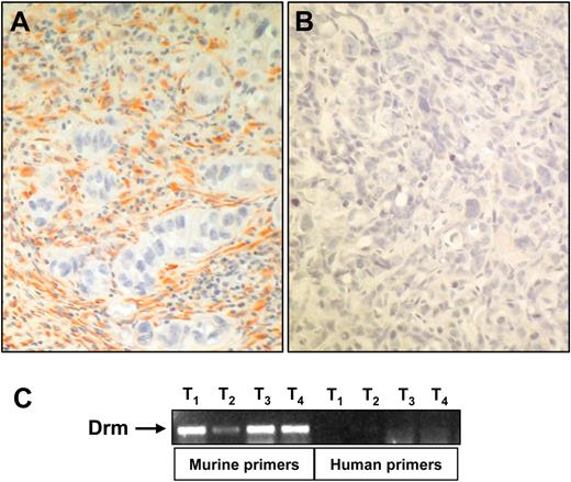 Figure 6. Drm/gremlin expression in tumor xenografts. (A) Drm/gremlin immunostaining of tumor xenografts originated in nude mice by subcutaneous injection of human endometrial adenocarcinoma HEC-1-B–derived cells. Note the Drm/gremlin immunoreactivity in tumor stroma, absent in tumor parenchyma. (B) Negative control in which the primary antibody was omitted. Original magnification, × 200. (C) RT-PCR analysis of 4 tumor xenografts (T) using murine and human specific Drm/gremlin primers.