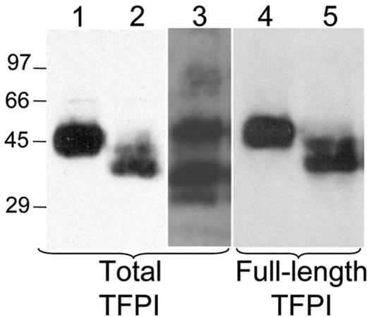 Figure 1. Western blot analysis demonstrates the presence of full-length TFPI in platelets. TFPI from plasma or from platelets lysed in 30 mM CHAPS buffer were precipitated with bovine factor Xa agarose and subjected to SDS-PAGE and Western blot analysis with either an antitotal TFPI antibody or an anti-TFPI antibody recognizing only the C-terminal 12 amino acids. Lanes 1 to 3 are stained for total TFPI; lanes 4 to 5 are stained for the C-terminal 12 amino acids. Lane 1 indicates platelet TFPI; lane 2, deglycosylated platelet TFPI; lane 3, plasma TFPI; lane 4, platelet TFPI; lane 5, deglycosylated platelet TFPI.