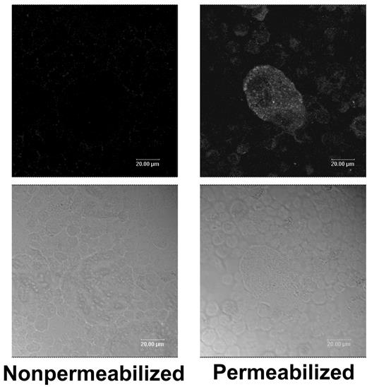 Figure 2. Fluorescence microscopy demonstrates TFPI within mouse megakaryocytes but not on their surface. Nonpermeablized and Triton–X-100–permeablized mouse megakaryocytes were immunostained for TFPI. Top panels are stained cells; bottom panels are bright field images of the cells.