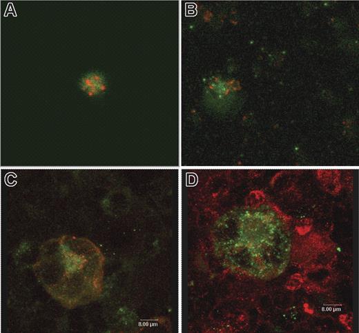 Figure 4. Confocal microscopy of mouse and human platelets and mouse megakaryocytes demonstrate that TFPI does not colocalize with either α granule or lysosomal protein. (A) Human platelets stained for TFPI (green) and fibrinogen as an α granule marker (red). (B) Mouse platelets stained for TFPI (green) and VWF as an α granule marker (red). (C) Mouse megakaryocytes stained for TFPI (green) and VWF as a α granule marker (red). (D) Mouse megakaryocytes stained for TFPI (green) and LAMP1 as a lysosome marker.