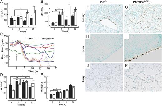 Figure 2. Organ distress in low-PC mice after LPS administration. Plasma levels of CK (A) and LDH (B) at various times after LPS (2 μg/g) in WT (▪) and PC−/−(PCTg785) (□) mice. Heart rate measurements (C) in individual WT (solid lines) and PC−/−(PCTg785) (dashed lines) mice after LPS (2 μg/g, administered at the time marked by the arrow). Plasma levels of ALT (D) and BUN (E) at various times after LPS (2 μg/g) in WT (▪) and PC−/−(PCTg785) (□) mice. For panels A-B and D-E, the data represent the means of n = 3-5 mice from each group. *Statistical significance with P < .05. TUNEL assays showing apoptosis (brown staining) in various organs from WT (F,H,J) and low-PC (G,I,K) mice at 12 hours after LPS (2 μg/g) exposure. Kidney (F-G), liver (H-I), and lung (J-K). Original magnification, × 200 for all panels. (A-B, D-E) Data are represented as mean ± SEM (n = 5).