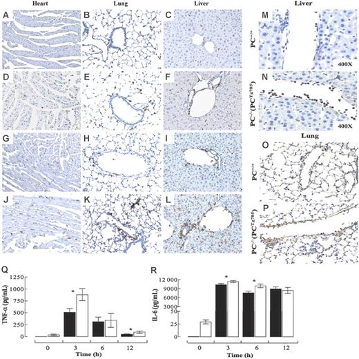 Figure 3. Inflammatory state in low-PC mice after LPS challenge. CD45+ immunostains (brown) in various organs from WT (A-C,G-I) or PC−/−(PCTg785) (D-F,J-L) mice at resting (A-F) and at 6 hours (G-L) after LPS (2 μg/g) administration. Neutrophils in the livers and lungs of WT (M-O) and PC−/−(PCTg785) (N-P) mice, respectively at 6 hours after LPS (2 μg/g) challenge. Original magnification, × 200 for all panels, unless indicated otherwise. Circulating levels of TNF-α (Q) and IL-6 (R) in WT (▪) and low-PC mice (□) at various times after LPS challenge. The values are means of 5 to 12 mice ± SEM.
