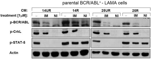 Figure 2. R-CM mediates BCR/ABL-independent activation of STAT-5. Western blotting. 14R-CM and 25R-CM causes a BCR/ABL-independent activation of STAT-5 in the presence of IM or NI. Activated (phosphorylated) BCR/ABL kinase (p-BCR/ABL) was demonstrated by staining for p-BCR/ABL and the phosphorylated direct substrate of BCR/ABL, p-CrkL. Activation of the BCR/ABL-substrate, STAT-5, was shown using phospho-STAT-5 (p-STAT-5)–specific antibodies. Actin served as loading control.