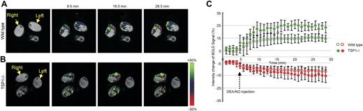 Figure 3. Endogenous TSP1 limits tissue perfusion responses to NO in vivo. BOLD MRI images for (A) WT and (B) TSP1-null mice were obtained from T2* weighted sequences. DEA/NO (100 nmol/g body weight) was injected with saline via an intrarectal cannula 5 minutes after starting the scan. Green and red colors show positive and negative BOLD MRI signals, respectively, at the indicated times after NO administration. The BOLD images were superimposed with the corresponding anatomic images to determine exact locations in the lateral thigh sections. (C) BOLD MRI signal changes as a function of time after NO challenge. The green and red plots show increased and decreased BOLD MRI signals, respectively. Values are presented as mean ± SD from 5 and 4 experiments in WT and TSP1-null mice, respectively.
