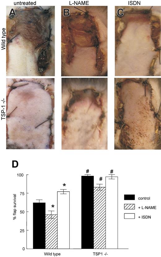 Figure 4. Endogenous TSP1 and NO modulate tissue survival under ischemic conditions. (A) Representative random flaps were photographed 7 days following surgery for untreated WT and TSP1-null mice, WT and TSP1-null mice receiving L-NAME (500 mg/L; B), or mice receiving ISDN (1 mg/mL; C) in the drinking water during the postoperative period. (D) Flap survival is expressed as the percentage of the total involved area. Results are the mean ± SD of 24 animals (12 age- and sex-matched pairs) of untreated WT and TSP1-null mice, 16 animals (8 matched pairs) treated with L-NAME, and 16 animals (8 matched pairs) treated with ISDN. *P < .05 versus control, one-way ANOVA. #P < .05 versus wild type, 2-way ANOVA.