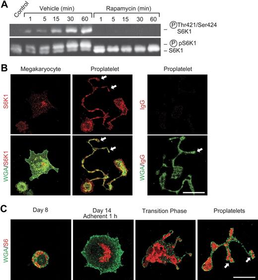 Figure 2. S6K1 and ribosomal protein S6 are distributed to proplatelets and S6K1 is activated in mature human platelets stimulated with thrombin. (A) Western analysis of total and phosphorylated S6K1 was done using lysates of washed human platelets that were pretreated with rapamycin (10 nM) or vehicle and subsequently stimulated with thrombin as in Figure 1. The bottom panel indicates mobility shift of S6K1 when phosphorylated in response to thrombin activation. The top panel illustrates results of incubations using an antibody that recognizes S6K1 phosphorylated on residues 421 and 424. (B) S6K1 is developmentally expressed in proplatelets and proplatelet tips. Megakaryocytes were cultured from CD34+ hematopoietic stem cells as in Figure 1. S6K1 is indicated by red fluorescence and is present in proplatelet tips (arrows). WGA localization is identified by green fluorescence. S6K1 was detected in proplatelet shafts and in proplatelet tips (middle panels, arrows) as proplatelets were extended during developmental transition (also see panel C). In the right panels, nonimmune IgG was substituted for anti-S6K1. (C) Ribosomal protein S6 is distributed to proplatelets and proplatelet tips in megakaryocyte development. S6 protein and WGA are indicated by red and green fluorescence, respectively. CD34+ hematopoietic stem cells were differentiated to the megakaryocytic stage.4 After 8 days in suspension culture S6 was diffusely distributed in the cytoplasm. One hour after adhesion to immobilized fibrinogen on day 14, S6 was centrally located in the perinuclear cytoplasm. During the transition phase, in which adherent megakaryocytic cells begin to form proplatelets, S6 was diffusely distributed in the central cytoplasm and in early proplatelet shafts. As proplatelets were extended, S6 was detected in early proplatelet tips (bottom right panel, arrows). (B-C) Scale bar, 20 μm.