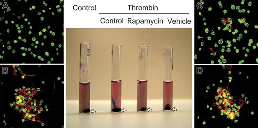 Figure 3. Rapamycin inhibits retraction of fibrin clots by activated human platelets. Washed human platelets were pretreated with buffer, rapamycin (10 nM), or the vehicle for rapamycin for 1 hour. Exogenous labeled fibrinogen was then added to the cells, and they were left unstimulated or activated with thrombin (1.0 U/mL) for 2 hours. Appearance of the platelet suspensions under each experimental condition is shown in the middle panel. The stir bar in each tube is indicated by an arrow. The panels labeled A to D are photomicrographs from tubes shown in the same order in the middle panel. Actin was stained in unactivated and activated platelets (green fluorescence). Red fluorescence indicates fibrin strands. The platelet suspension in the first tube (control) is opaque, indicating dispersed, single unactivated platelets as seen by microscopy (A). No polymerized fibrin is present. Thrombin-stimulated platelets in the second tube have formed a tight fibrin clot adherent to the stir bar at the bottom, with clear media containing few residual platelets above. By microscopy, the clot consisted of platelet-fibrin complexes (B). After pretreatment with rapamycin, thrombin-stimulated platelets in the third tube formed a loose, gelatinous clot that was only slightly retracted, revealing clear media just below the meniscus. Polymerized fibrin was present but was much more dispersed (C). Activated platelets treated with vehicle for rapamycin in the fourth tube formed a tightly retracted fibrin clot around the stir bar at the bottom with clear media above, equivalent to the response of control platelets. Microscopically, the clot consisted of aggregated platelets and tightly retracted polymerized fibrin (D), similar to the clot in the control incubations (B). This figure is representative of 4 separate experiments.