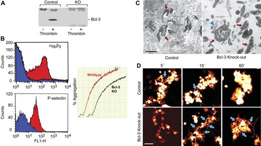 Figure 5. Retraction of platelet-fibrin clots is attenuated by deletion of Bcl-3 in murine platelets. (A) Platelets were isolated from Bcl-3−/− and WT mice as described in “Materials and methods.” The cells were left quiescent or were activated and were then probed for Bcl-3 by Western analysis. (B) Platelets from Bcl-3–deficient and WT mice were left quiescent or activated with thrombin (0.5 U/mL) for 5 minutes and then examined for surface P-selectin or integrin αIIbβ3 by flow cytometry as described in “Materials and methods.” Blue and red areas indicate staining by anti-αIIbβ3 or anti–P-selectin and as control immunoglobulin, respectively. In the right panel, thrombin (0.1 U/mL) was added to the PRP from WT or Bcl-3−/− animals, and aggregation was monitored as described in “Materials and methods.” Similar results were observed when ADP was used as an agonist (data not shown). (C) PRP was collected from Bcl-3−/− and WT mice and normalized for platelet counts. The PRP was then left quiescent or stimulated with thrombin. After 2 hours, samples of the platelet-fibrin clots were prepared for transmission electron microscopy (“Materials and methods”). (Left) Dense fibrin complexes formed around irregularly shaped, spiculated platelets in the PRP from control animals. The red arrows point to platelets surrounded by electron-dense fibrin complexes, with other platelets enmeshed in dense fibrin nearby. (Right) Dense fibrin polymers were infrequent in suspensions of Bcl-3–deficient platelets. The blue arrowhead points to a small area of dense fibrin mesh adjacent to a Bcl-3−/− platelet, with other platelets and a few scattered fibrin complexes nearby. The Bcl-3−/− platelets (3 are indicated by red arrows) were less spiculated and tended to retain discoid shape. Scale bar, 2 μm. (D) WT or Bcl-3−/− murine platelets were isolated, resuspended in media containing fluorescently labeled fibrinogen, and stimulated with thrombin. Platelet aggregation and the organization of labeled fibrin complexes were examined at the designated time points. WT platelets bound labeled fibrin on their surfaces, giving them a white/orange globular appearance, and retracted fluorescently labeled fibrin into dense, compact masses around the platelet aggregates. A few individual fibrin strands were visible at early time points (blue arrows) but had been retracted into the tight platelet-fibrin mesh by 60 minutes. Incubations with platelets from Bcl-3–deficient animals resulted in loose complexes of labeled fibers. Individual fibrin strands were easily visible at 15 minutes and 60 minutes (blue arrows, bottom panels), in contrast to their paucity the incubations with WT platelets (top panels). Data in this figure are representative of 3 independent experiments. Scale bar, 5 μm.