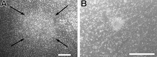 Figure 2. CFU-EC and ECFC colonies generated from discarded cells from methods A and B. (A) Representative photomicrograph phase-contrast of an ECFC colony, which arose when the adherent cells discarded from method A were cultured in EGM-2 medium (method B). Similar colonies were observed from 4 other adult peripheral and 5 cord blood donors. Arrows indicate colony boundary and scale bar represents 500 μm. (B) Representative phase-contrast photomicrograph of a CFU-EC colony, which arose when the nonadherent cells discarded from method B were cultured by method A. Similar colonies were observed from 4 other adult peripheral and 5 cord blood donors. Scale bar represents 500 μm.