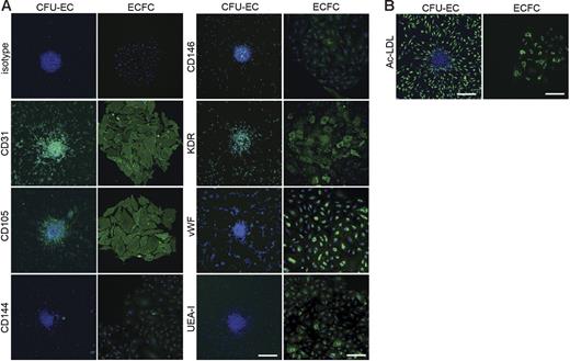 Figure 3. Expression of endothelial cell antigens by CFU-ECs and ECFCs. (A) Immunophenotyping of CFU-EC and ECFC colonies by confocal microscopy. CFU-ECs and ECFCs express CD31, CD105, CD144, CD146, KDR, VWF, and UEA-I. Shown are isotype and antigen staining (green) representing 5 independent experiments using cells from different donors. Nuclei are stained with Hoechst 33342 (blue) and scale bar represents 200 μm. (B) CFU-ECs and ECFCs incorporate Ac-LDL. Shown is a confocal photomicrograph of cells that have taken up Ac-LDL (green) following a 4-hour incubation, representing 5 independent experiments using cells from different donors. Nuclei are stained with Hoechst 33342 (blue) and scale bar represents 200 μm.